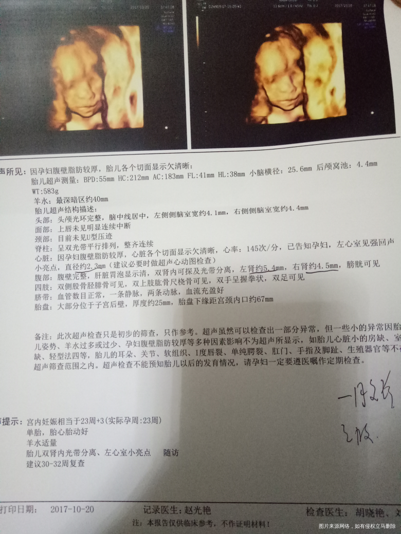 医生帮忙看看 严重不 好怕