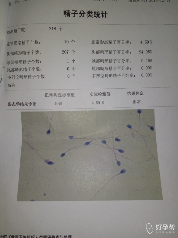 麻烦帮看男方的dna碎片结果