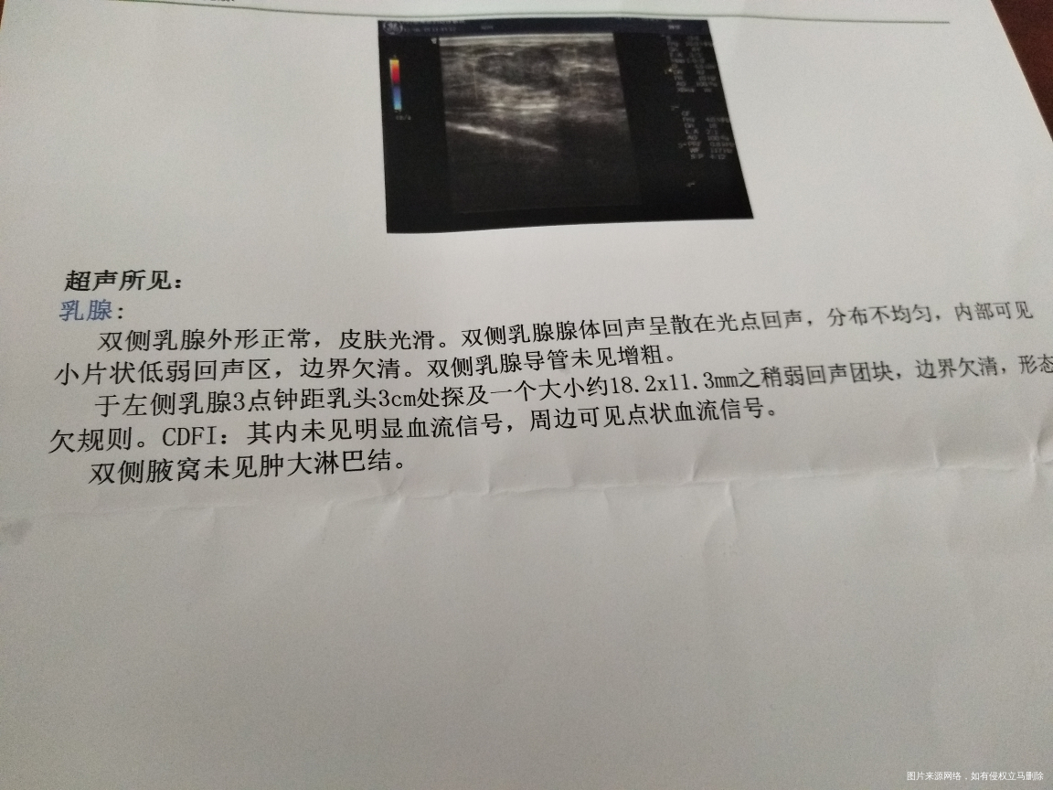 孕16周左侧乳房疼痛