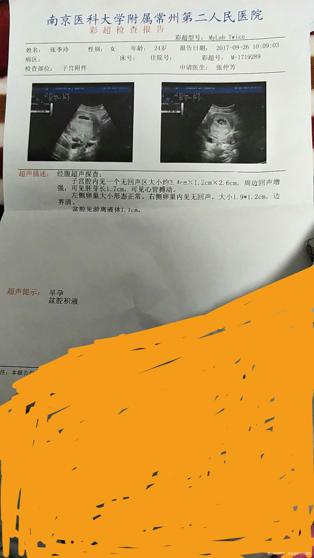 帮忙看一下检查结果好不好