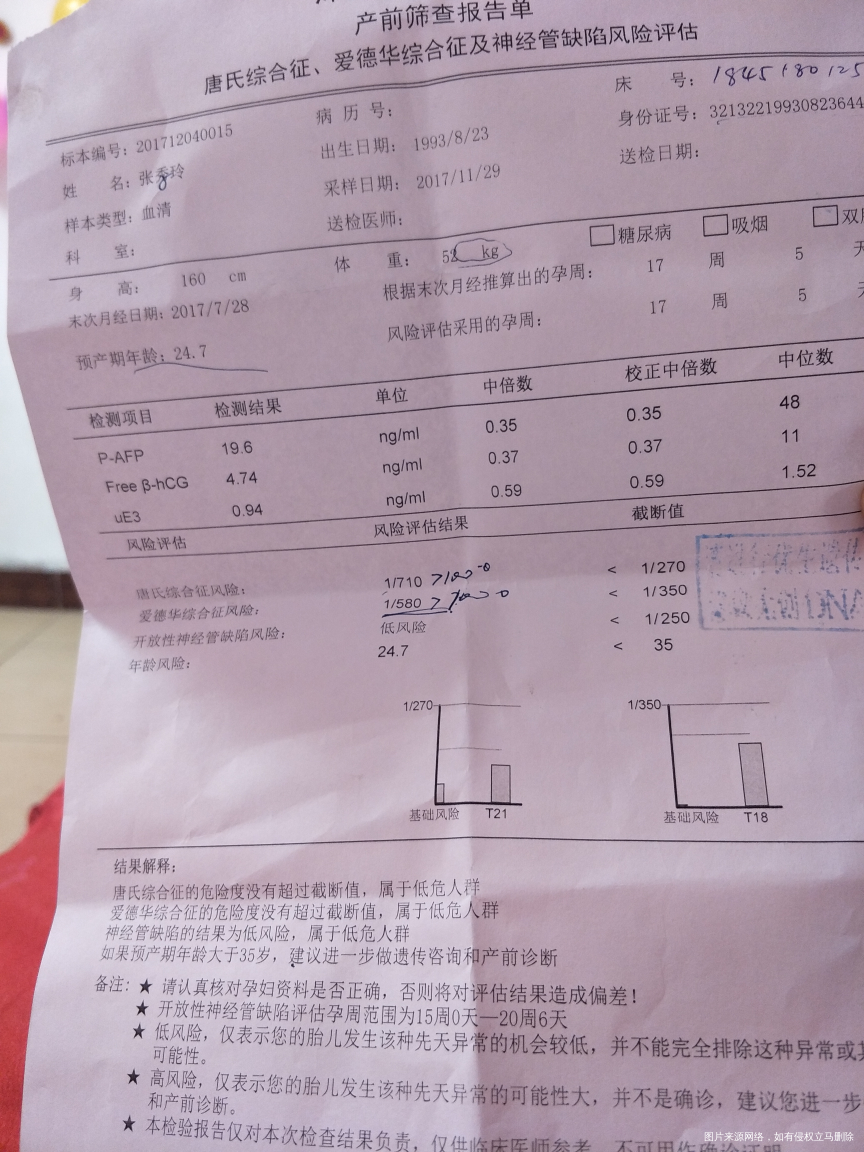 今天刚拿到唐氏筛查的单子,帮忙看一下结果