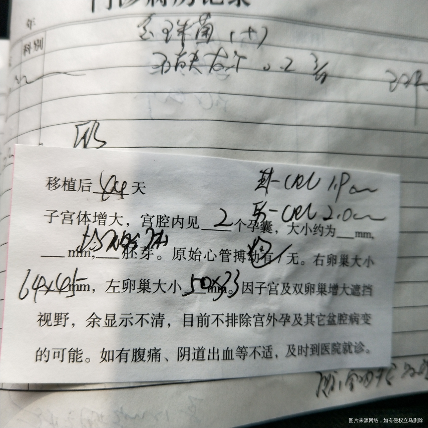 二超通过了,但是卵巢反而变大了