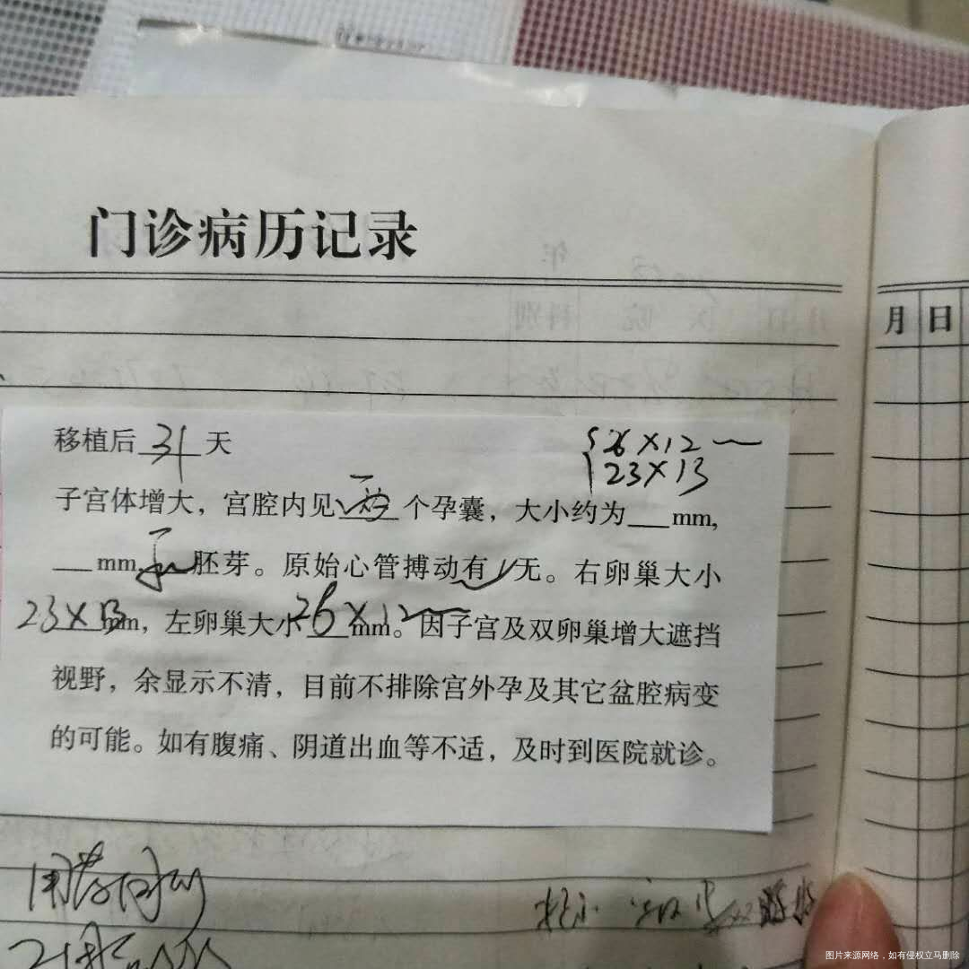 二超通过了,但是卵巢反而变大了