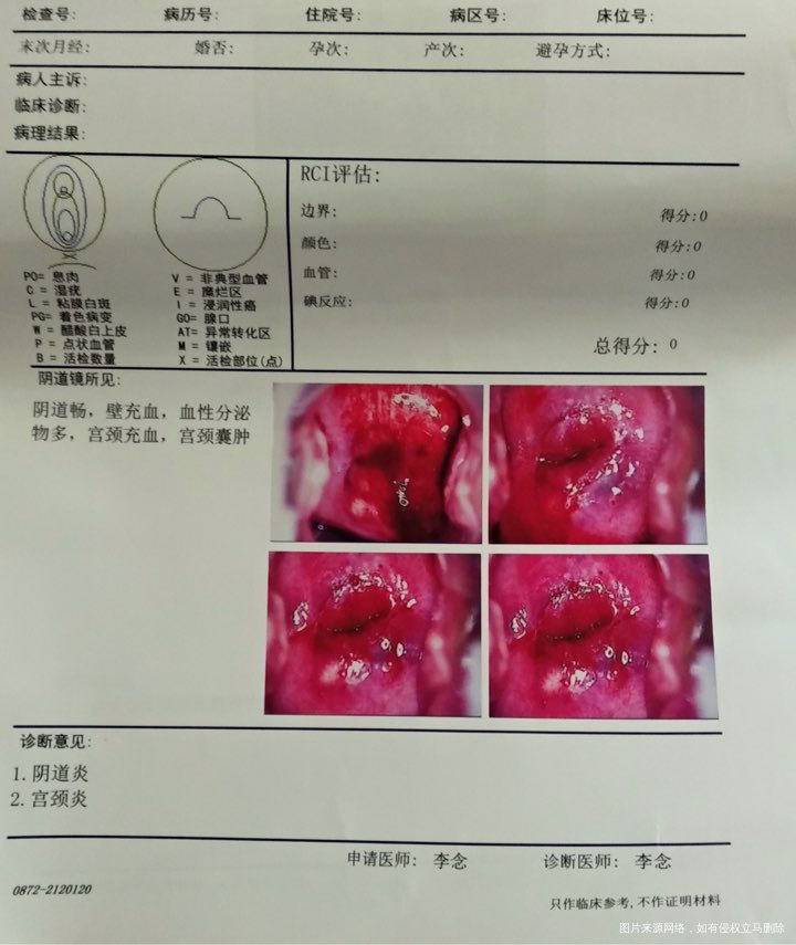 想请妇科医生帮忙看看妈妈的检查化验单,谢谢🙏