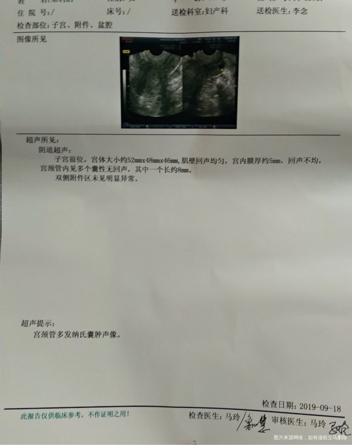 想请妇科医生帮忙看看妈妈的检查化验单,谢谢🙏