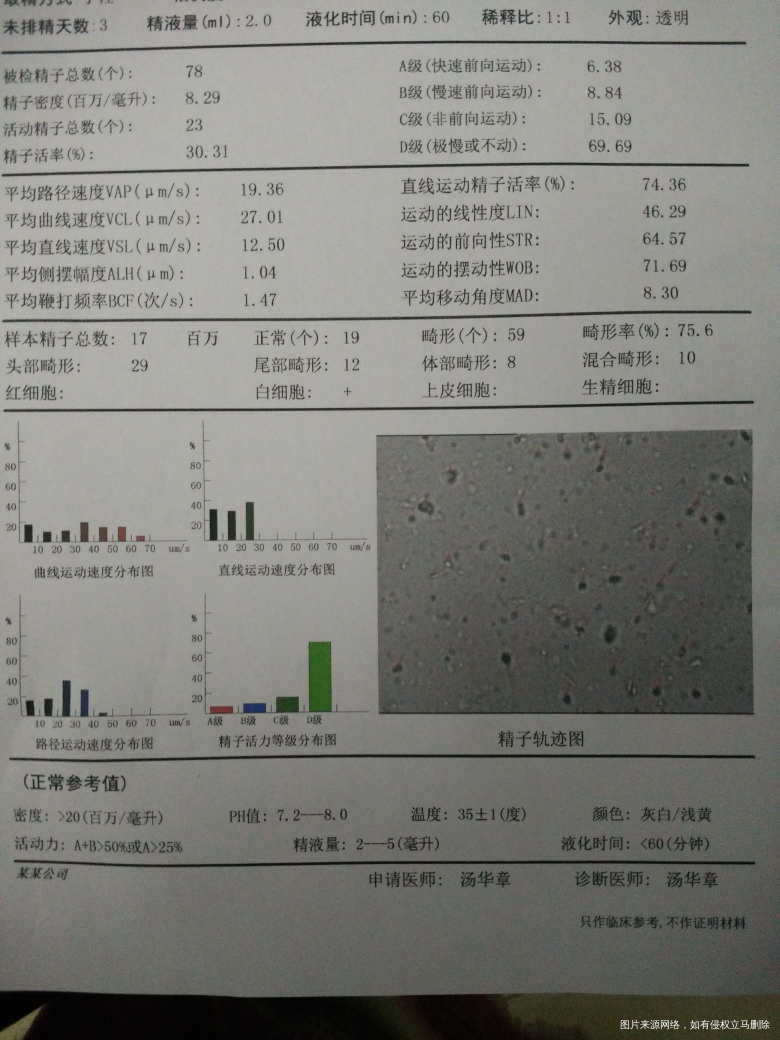 麻烦帮我看看,这个精液报表