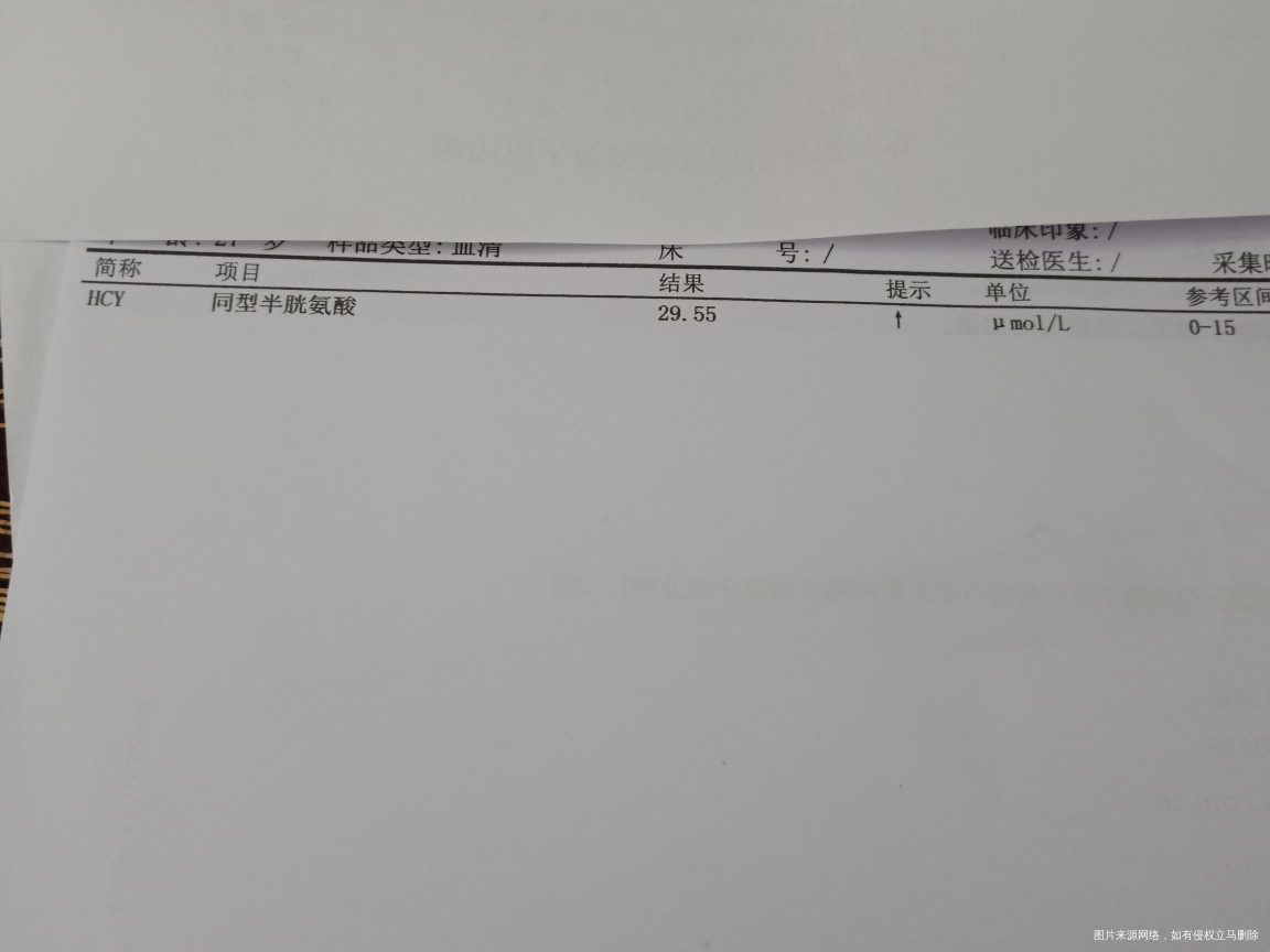 求医生帮我看看,造影非要做么?能不能不做