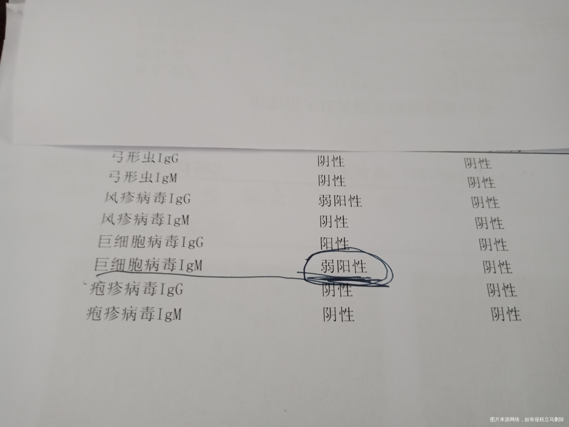 求医生帮我看看,造影非要做么?能不能不做