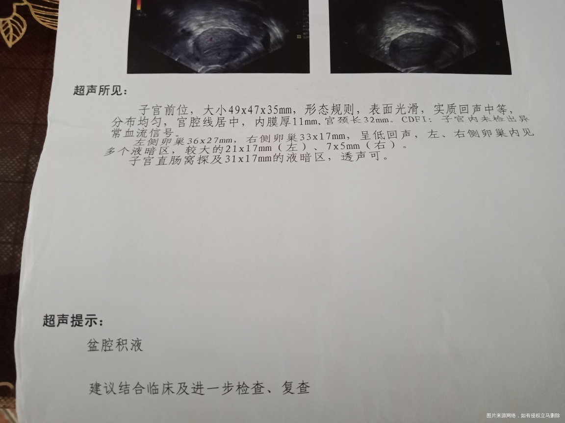 求医生帮我看看,造影非要做么?能不能不做