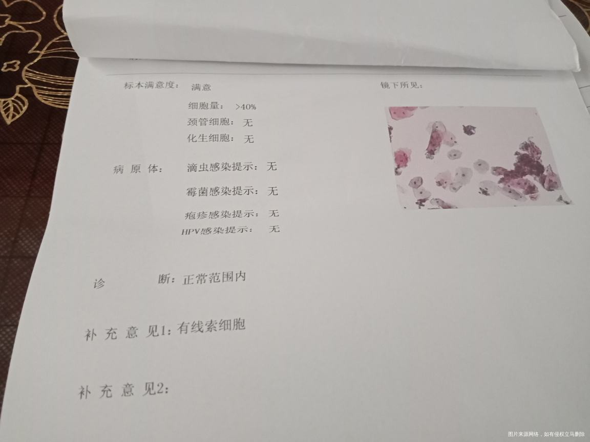 求医生帮我看看,造影非要做么?能不能不做