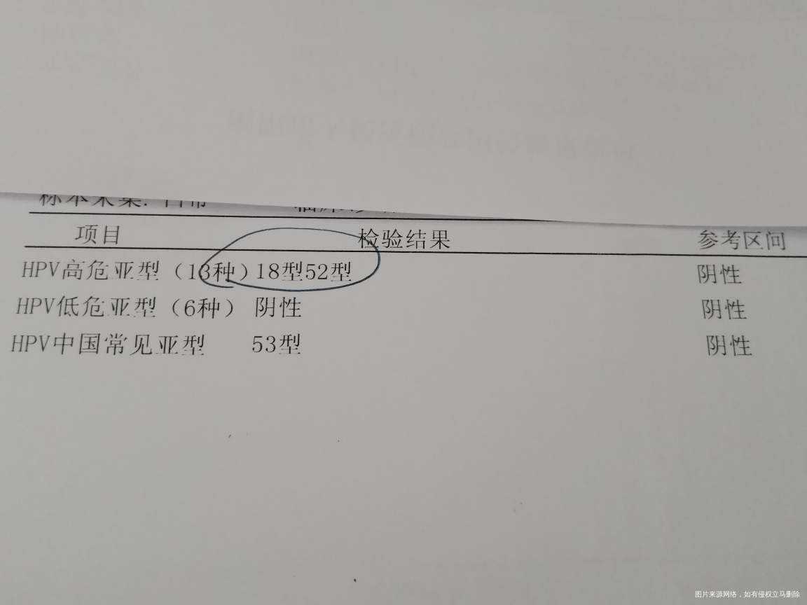 求医生帮我看看,造影非要做么?能不能不做