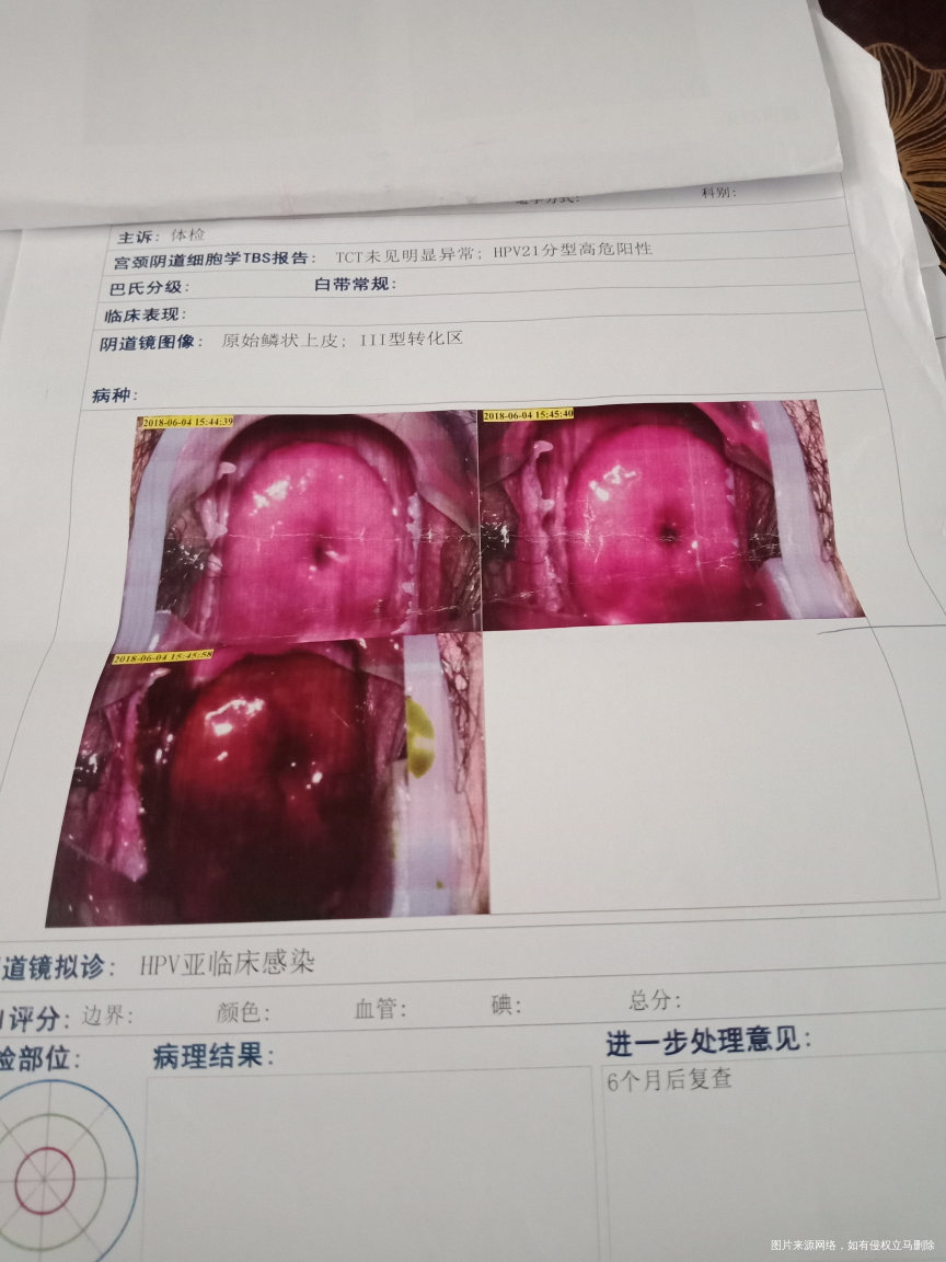 求医生帮我看看,造影非要做么?能不能不做