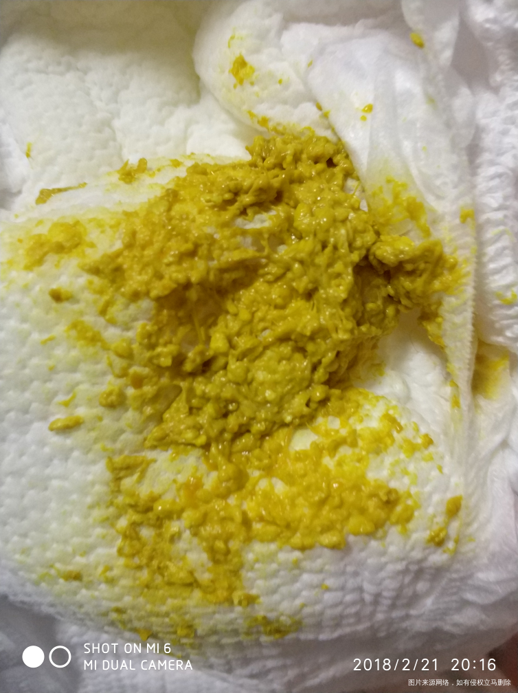 医生帮我看一看宝宝是不是拉肚子?