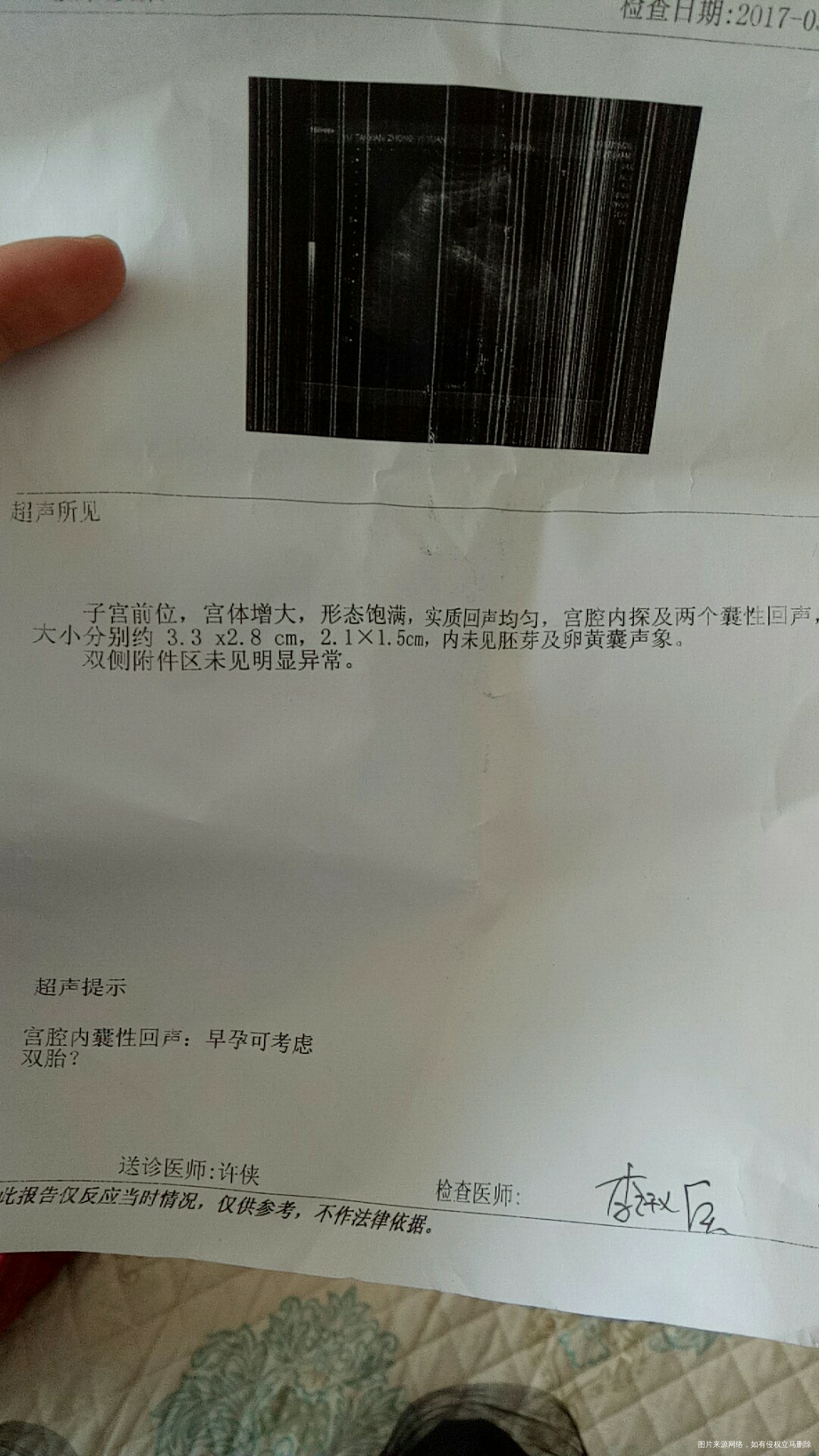 4.1号末次月经,今天检查还没有胎心胎芽