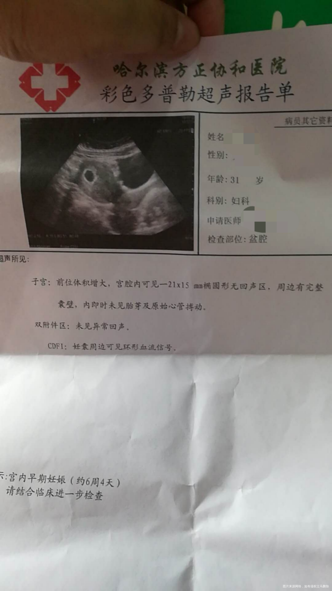 6周+4天,没看见胎心胎囊!