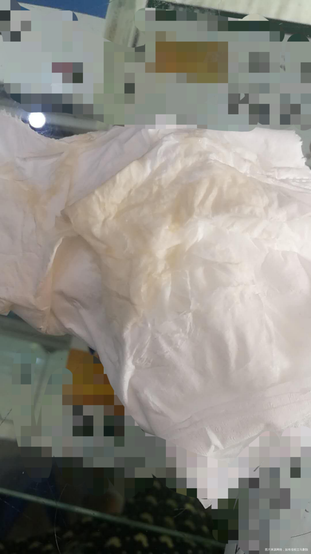 麻烦大夫看一下!孕6+5,有分泌物