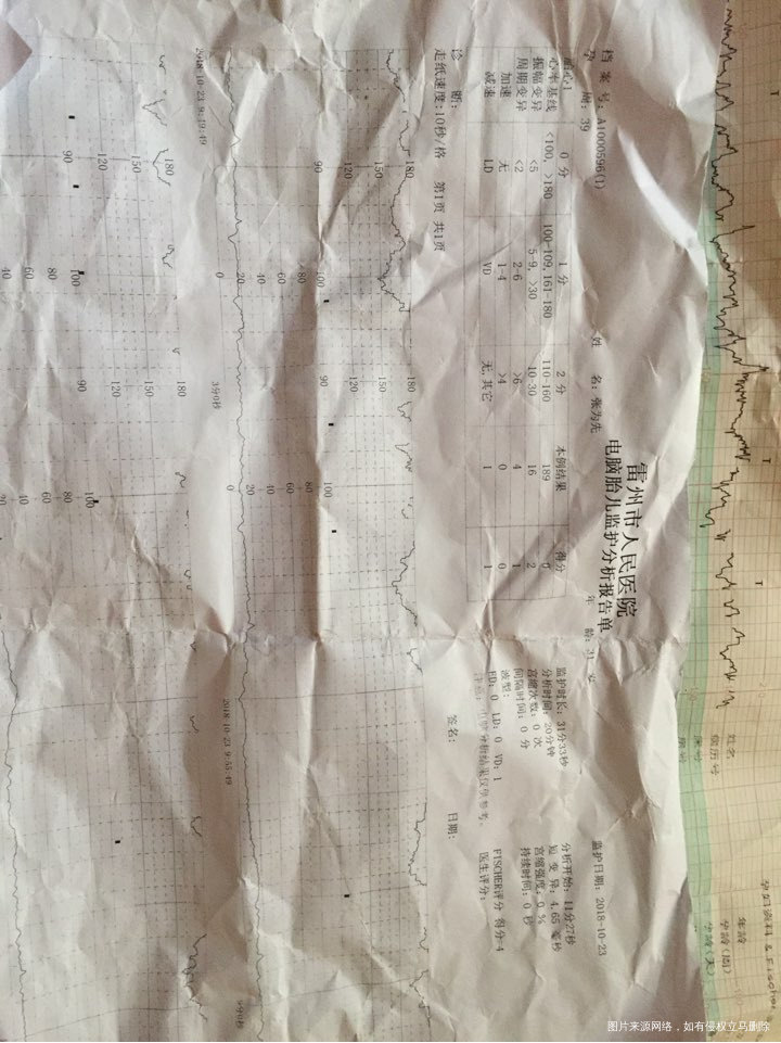 你好医生帮忙看看胎心为什么那么快,做了两次胎监和照了彩超