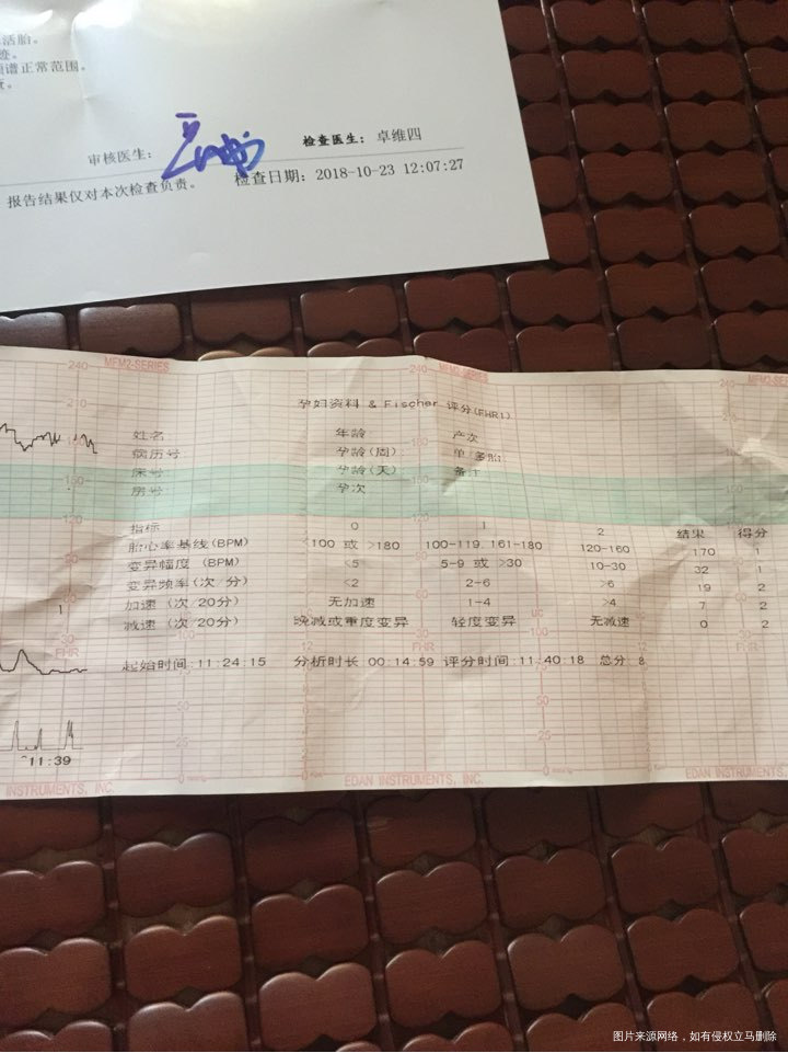 你好医生帮忙看看胎心为什么那么快,做了两次胎监和照了彩超