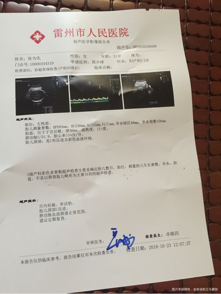 你好医生帮忙看看胎心为什么那么快,做了两次胎监和照了彩超