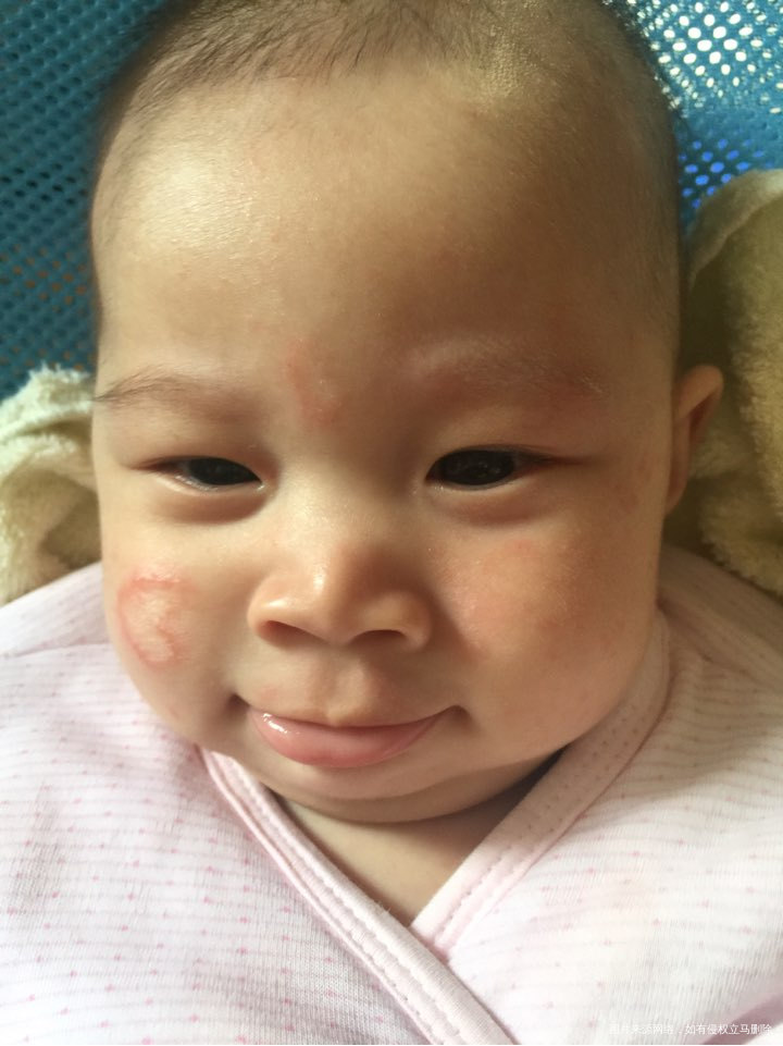 麻烦医生看看,急急急急急急