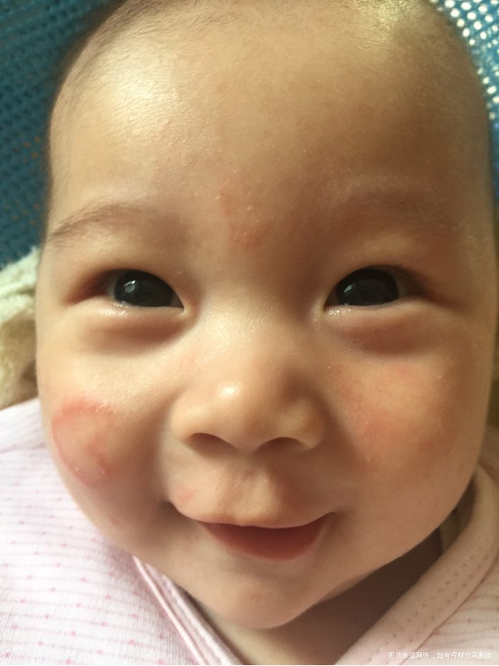 麻烦医生看看,急急急急急急