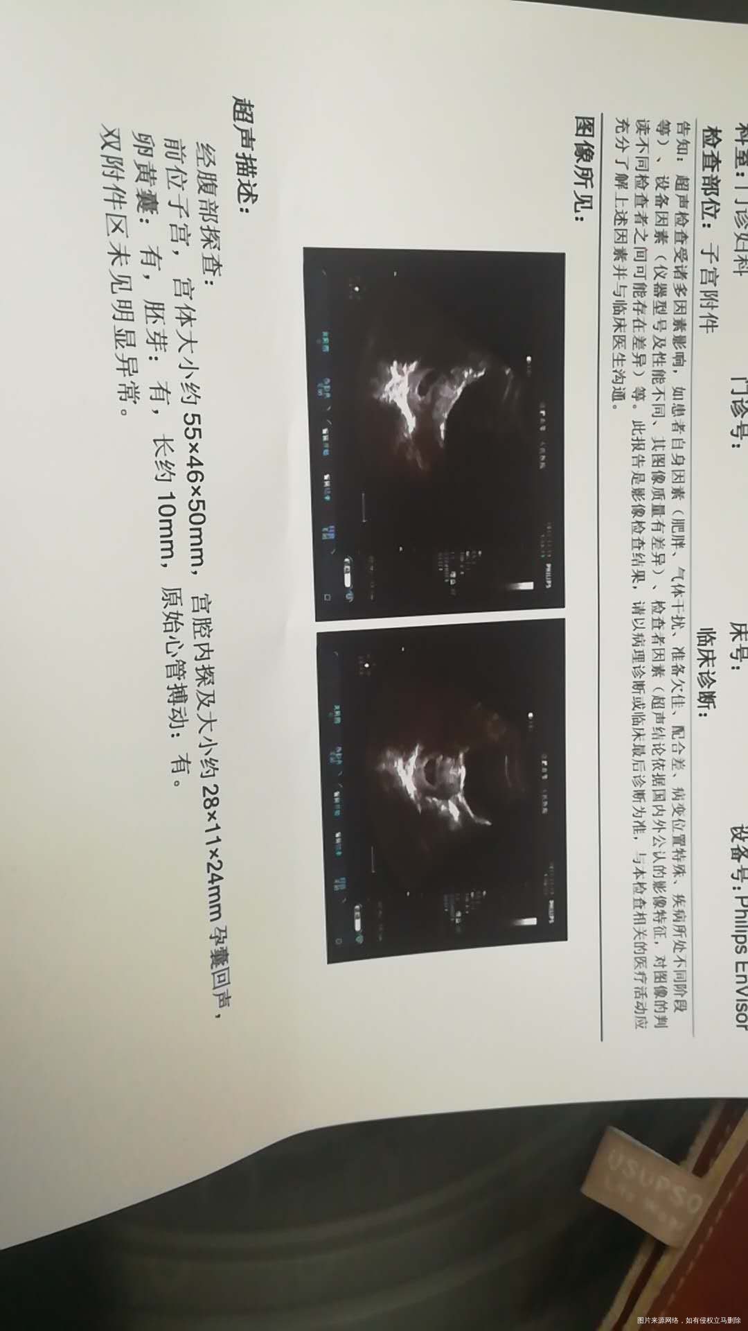 今天刚做的B超,医生帮我看看谢谢