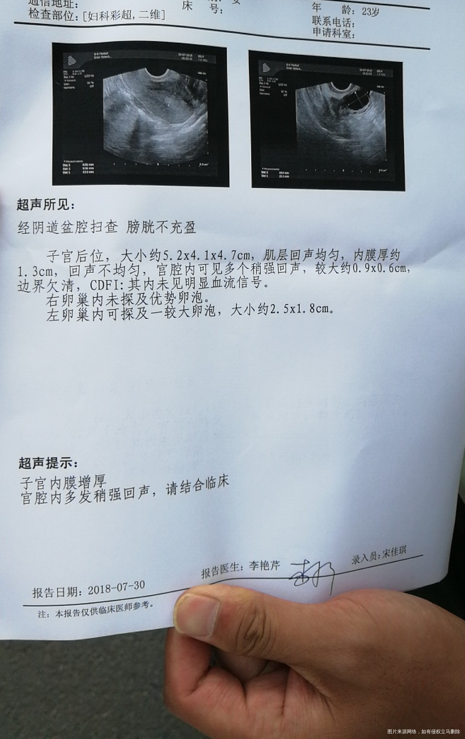 促排后卵泡只长不排怎么办,