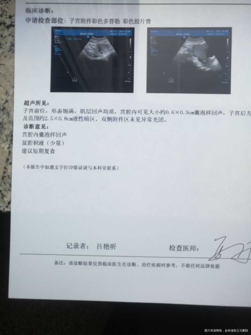 末次月经9月15日,现在算怀孕44周,这样的B超结果有点担心,医生帮忙看看