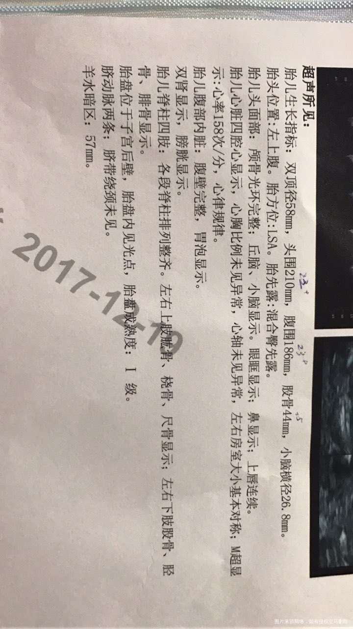 医生帮忙看下,24周的四维彩超