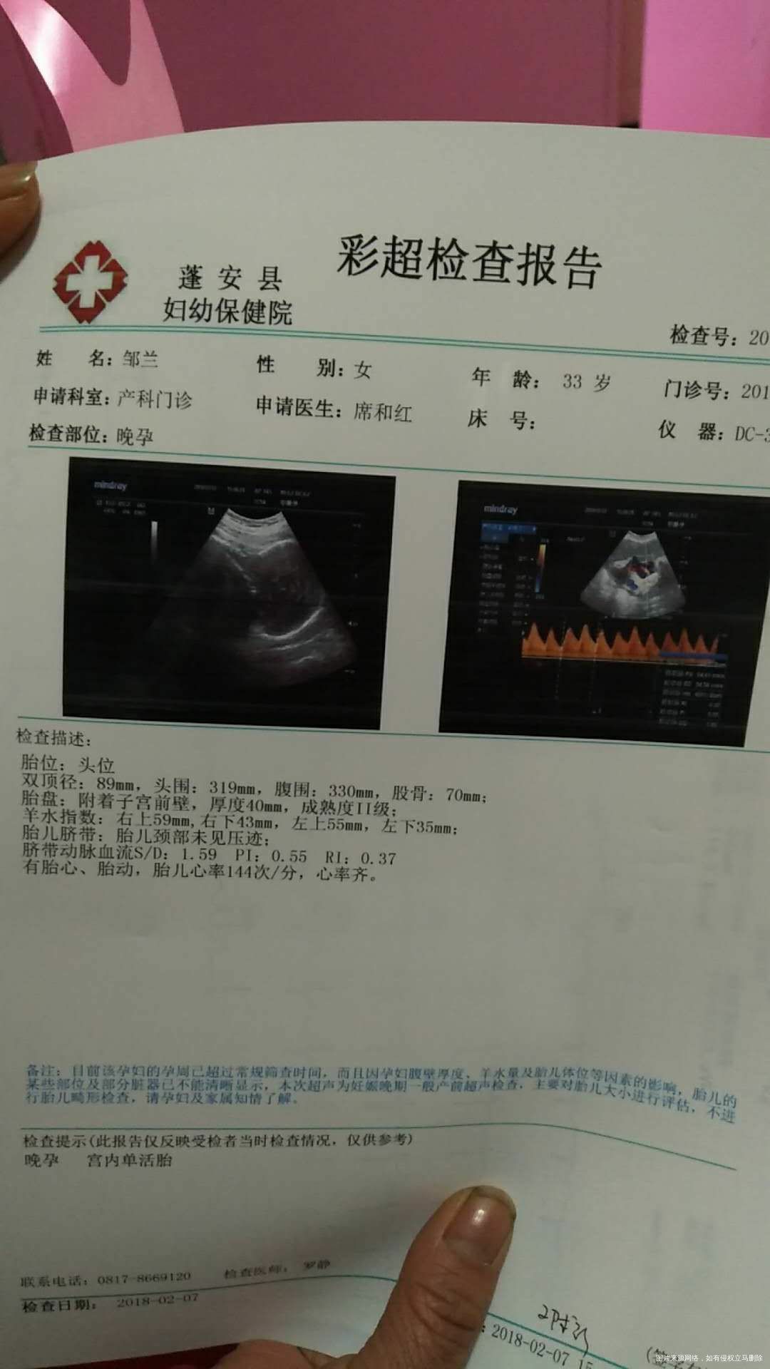 37周B超为什么没有告知胎儿多少斤呢?