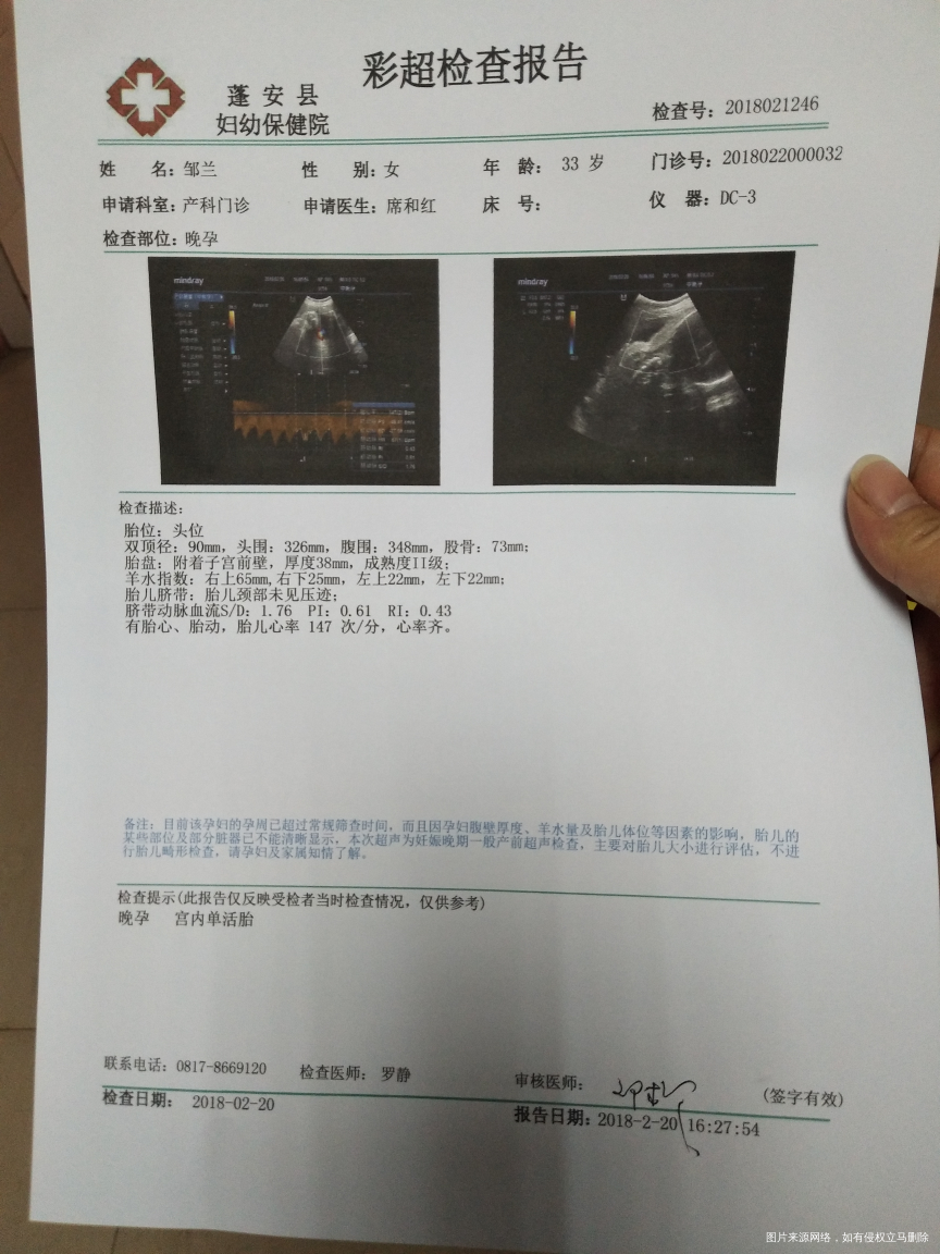 宝宝38+6的B超麻烦医生帮忙看看