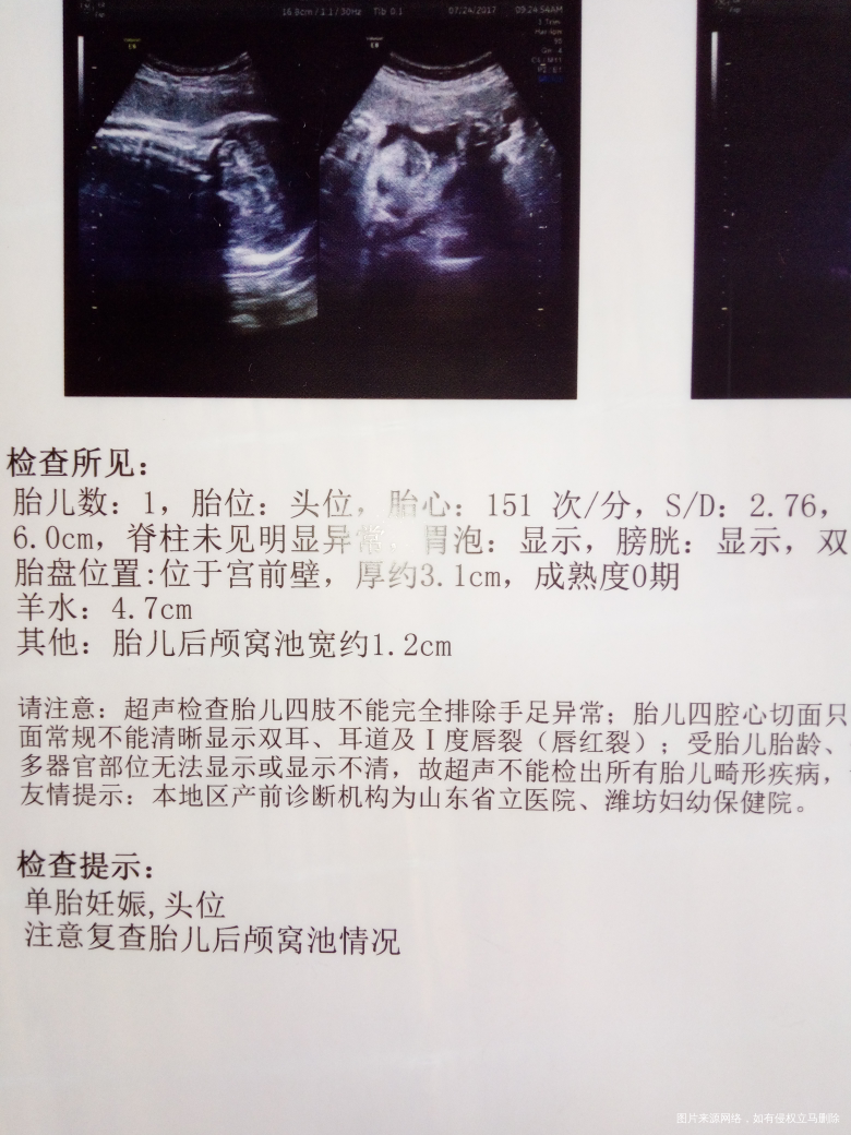 麻烦大夫们帮忙看看有没有影响