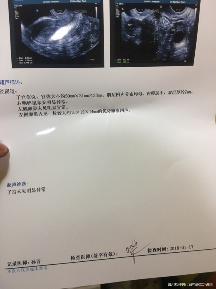 麻烦医生看下阴超检测卵泡情况