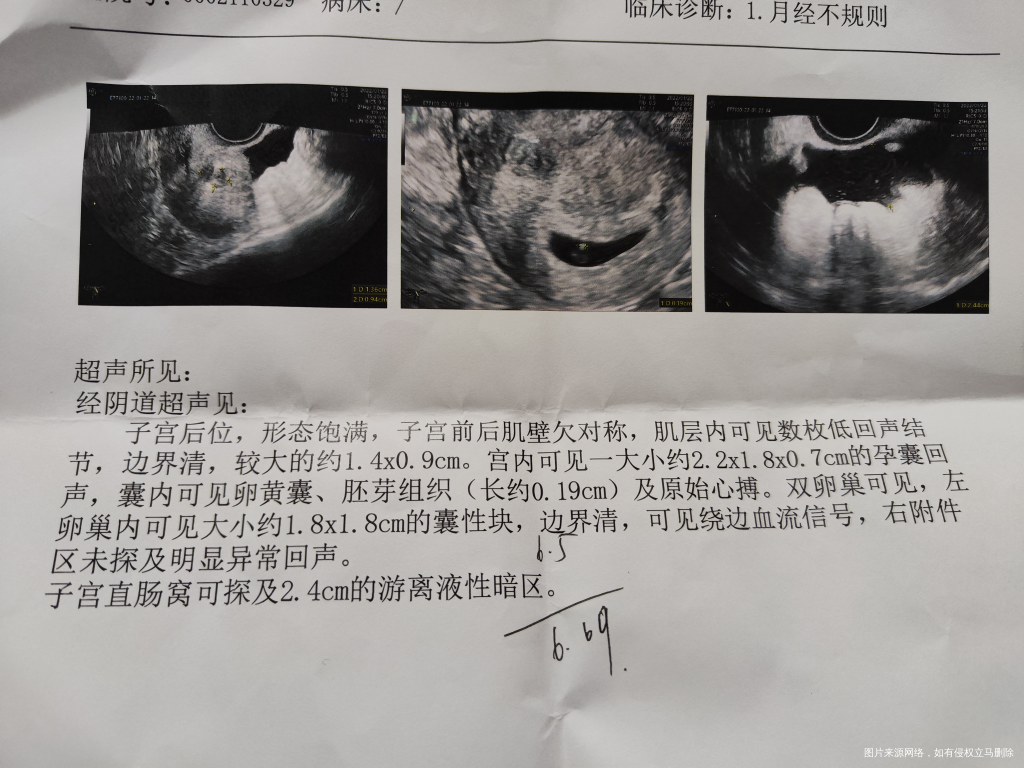 上次月经12.06,因为一直避孕套避孕,