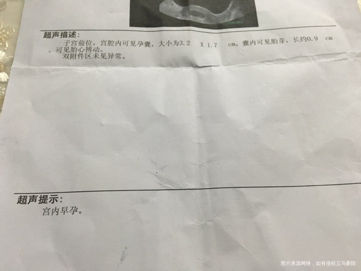 医生帮忙看看 孕7周+1 彩超检查 正常吗 初孕听讲b超检查就好 彩超会影响胎儿吗
