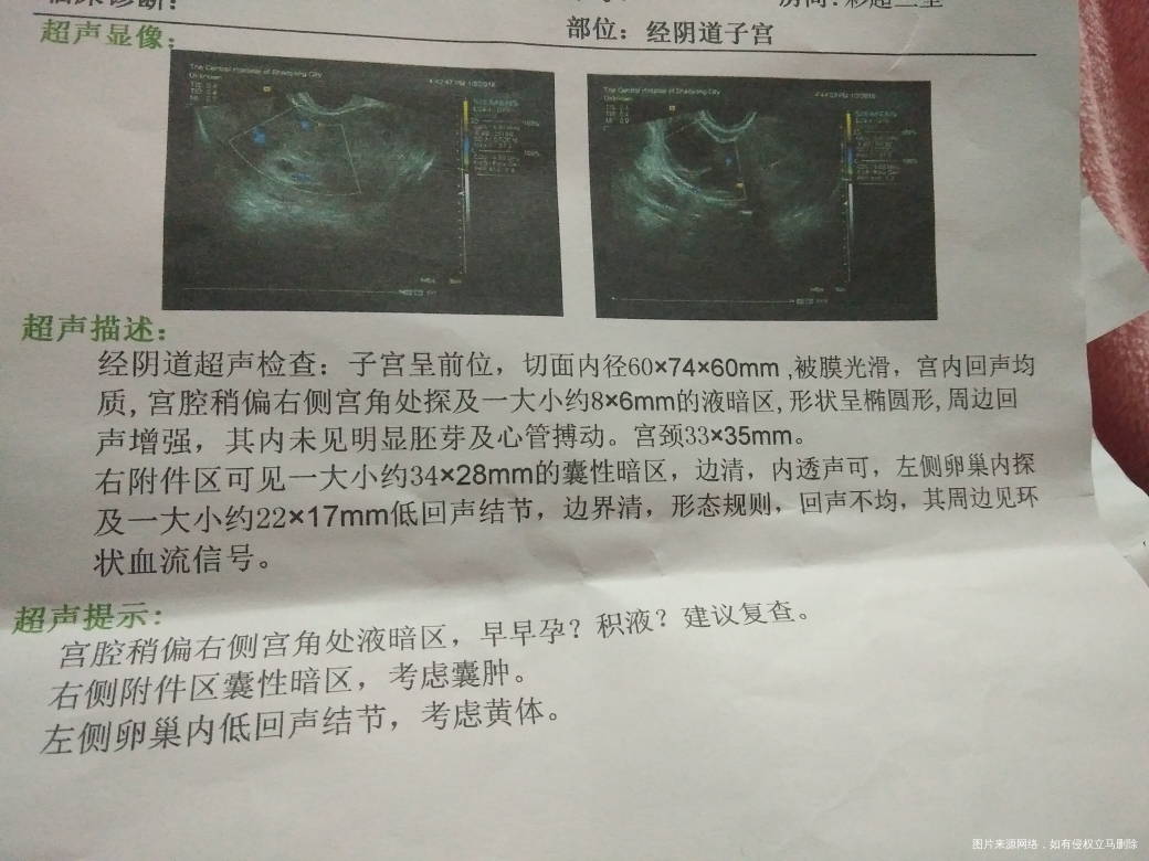 麻烦医生帮我看看移植第27天的B超