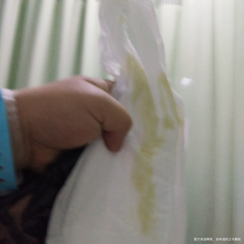 医生请问我这是羊水还是白带![/stor