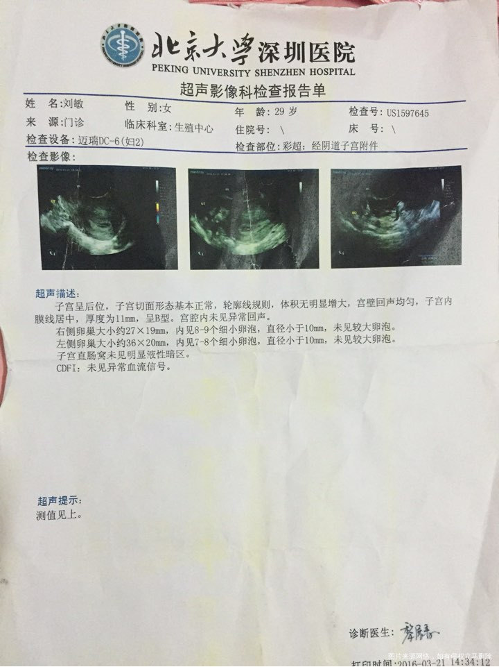 备孕2⃣️年了,之前断断续续一直没怀孕,去年3月在医院做检查,试孕一年还是没怀了迷茫