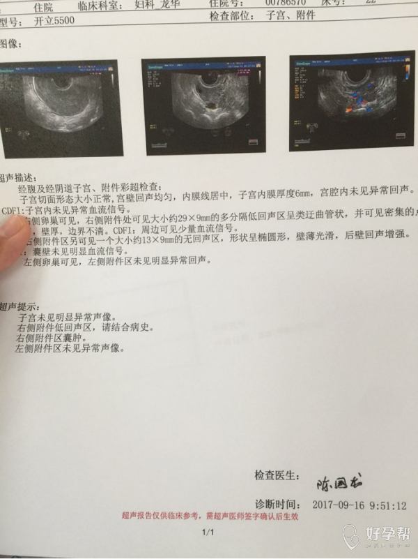 超声诊断报告,右侧附件囊肿,我是8月27号促排取过卵,这个结果是不是有