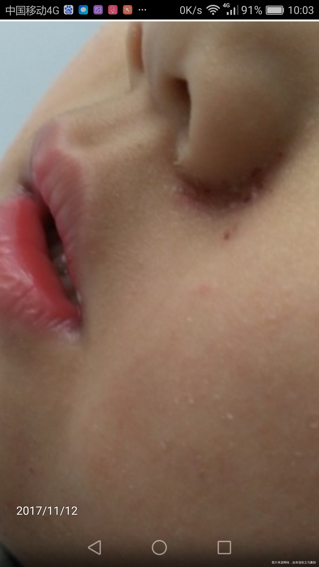 医生帮帮忙,需要您的帮助,谢谢