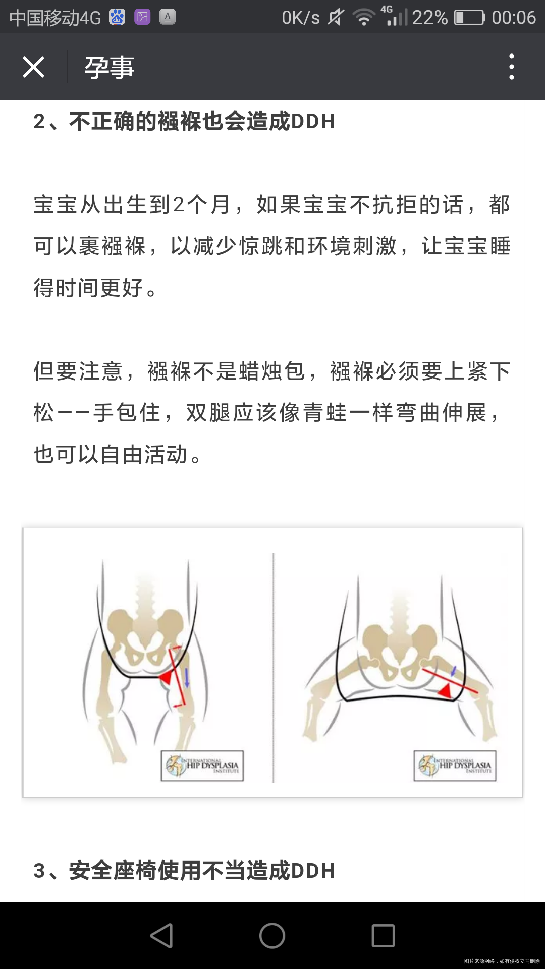 宝宝臀纹不对称1岁以后发现就晚了