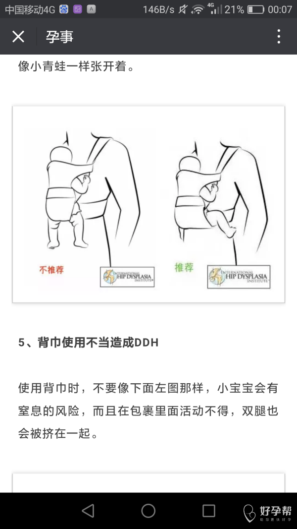 宝宝臀纹不对称,1岁以后发现就晚了