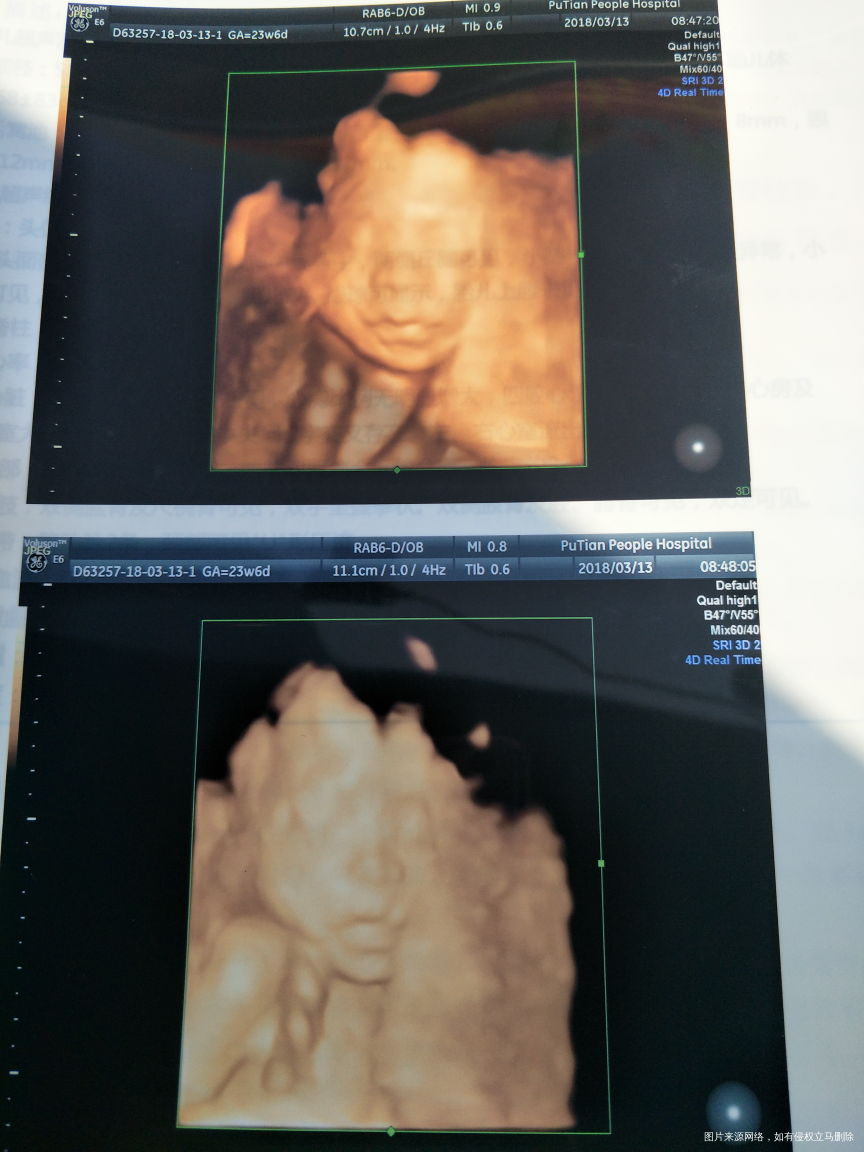 想看看是男孩女孩,方便买衣服