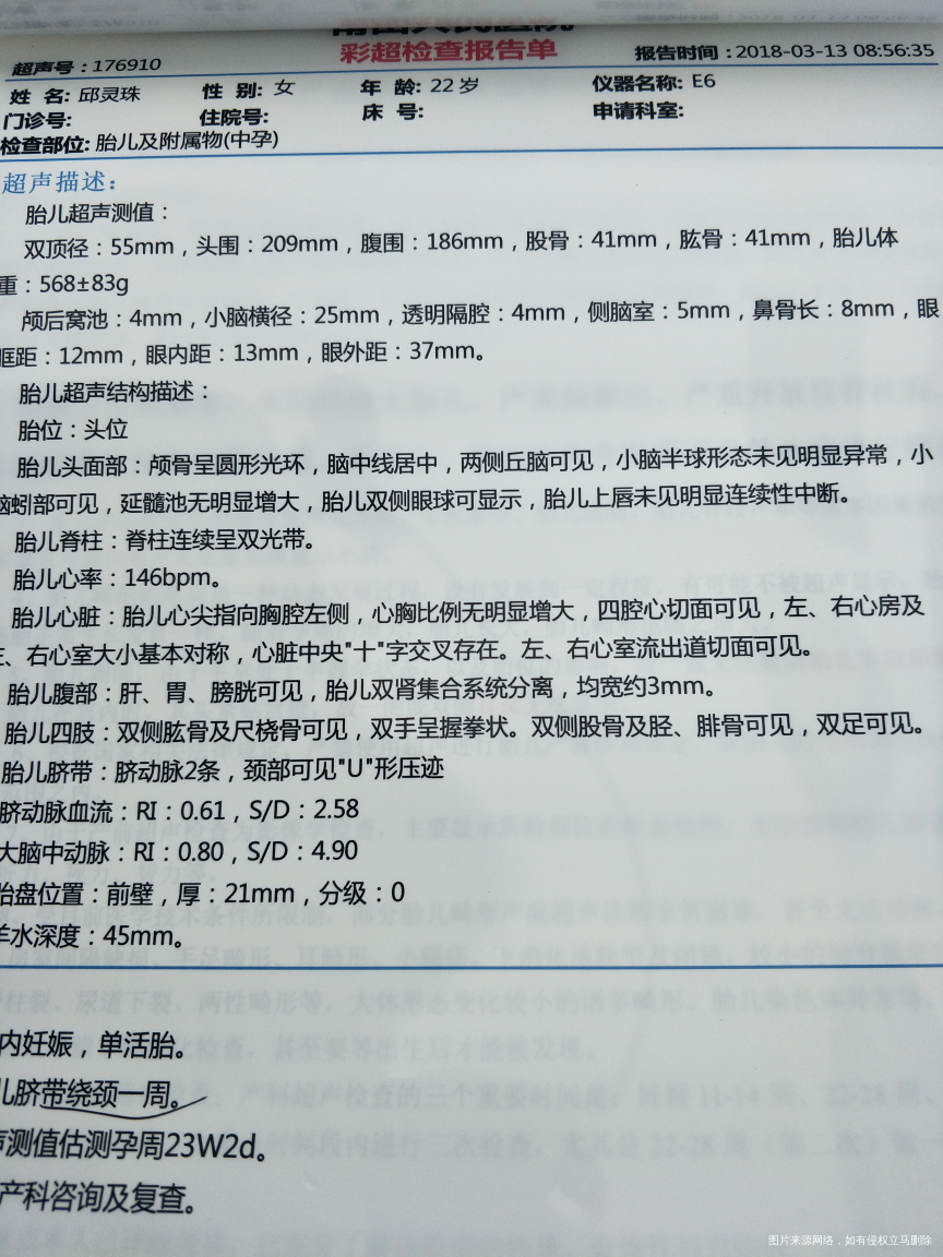 想看看是男孩女孩,方便买衣服