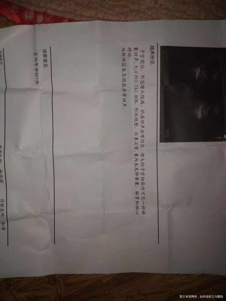 怀孕七周只看见孕囊没有看到胎心胎芽搏动!