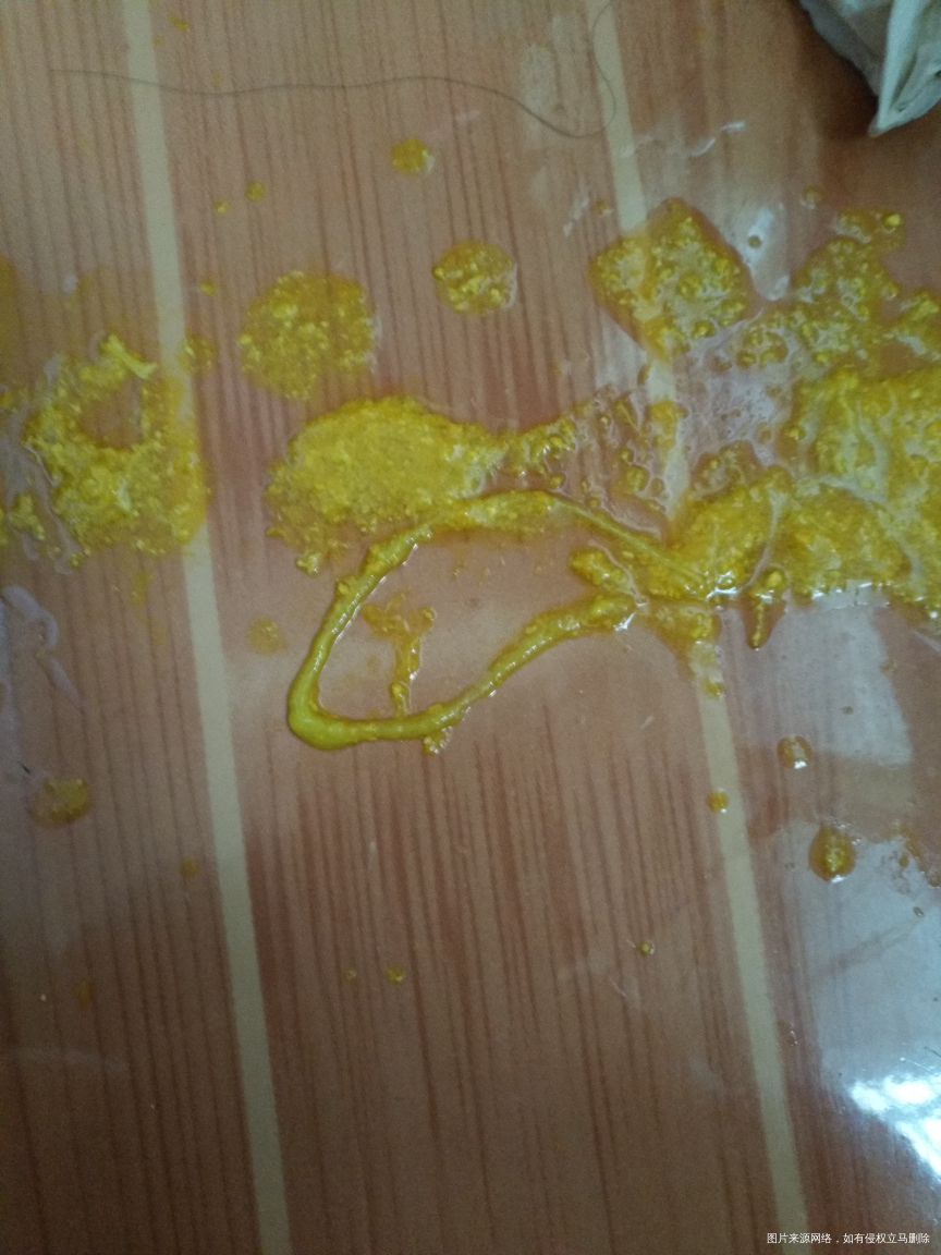 40天的宝宝拉的这是啥?