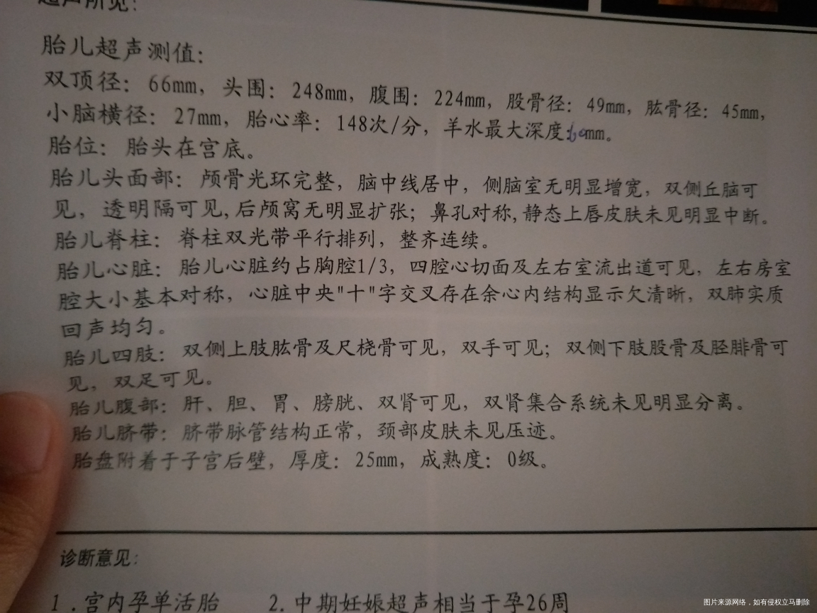 四维单子,怎么看男女啊