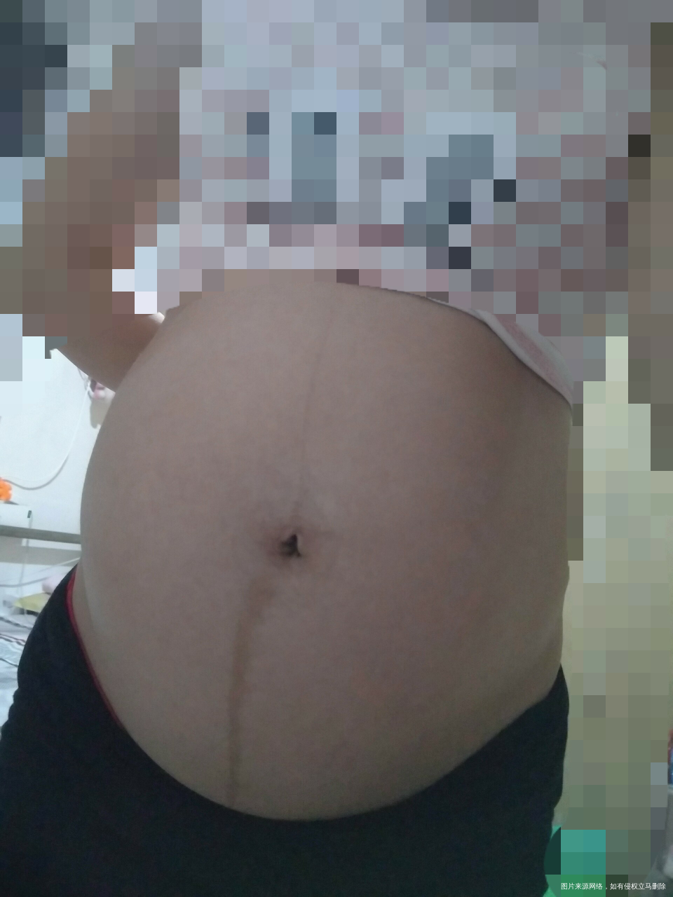 好多地方变黑了,你们有吗,请看图