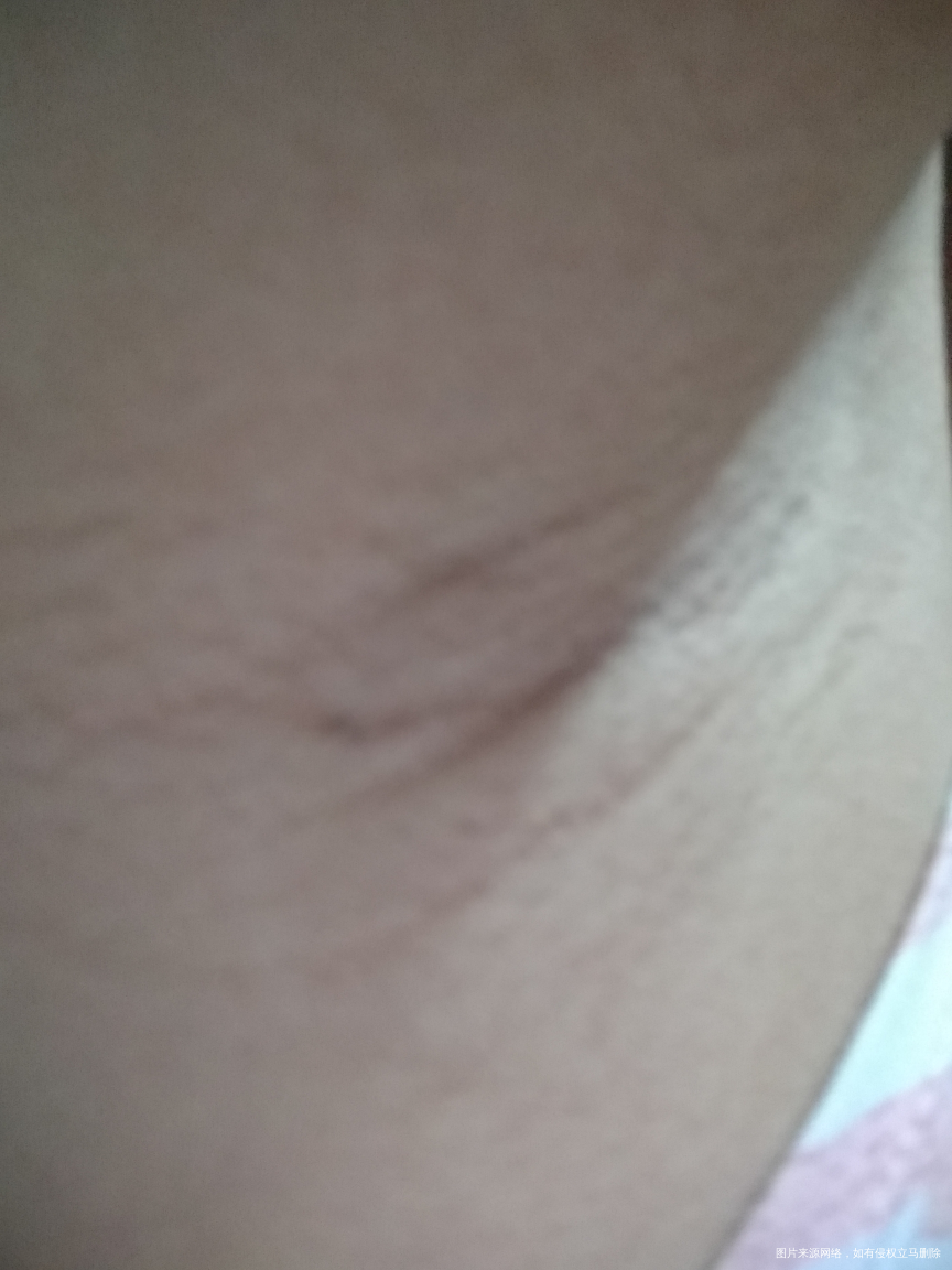 好多地方变黑了,你们有吗,请看图