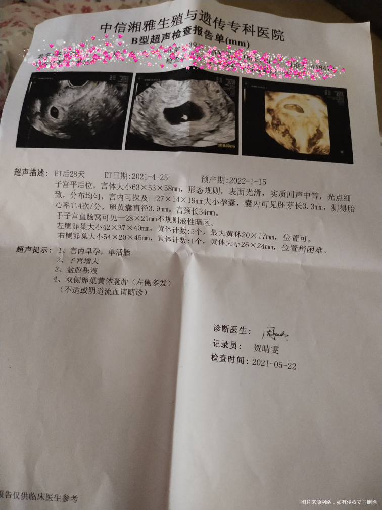 4月25号移植两枚鲜胚,5月22号28天做B超只看到了一个,还有一个有点担心在宫...